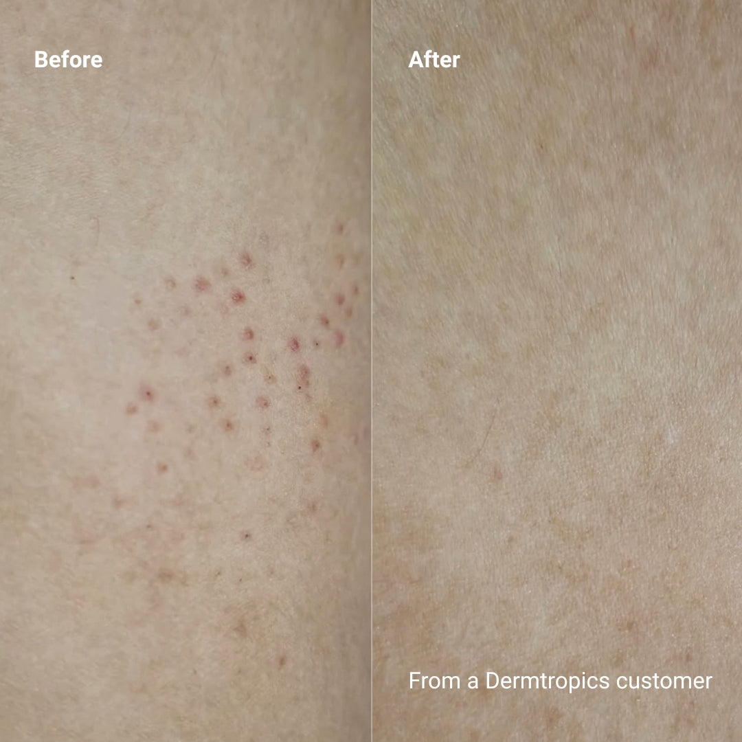 Dermtropics Body Moisturizing Duo