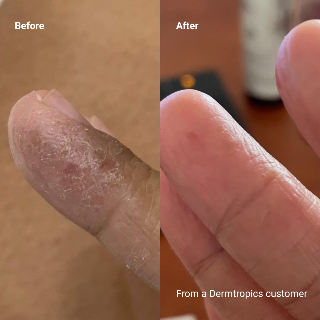 Dermtropics Body Moisturizing Duo