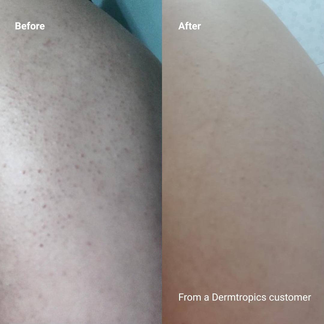 Dermtropics Body Soothing Duo
