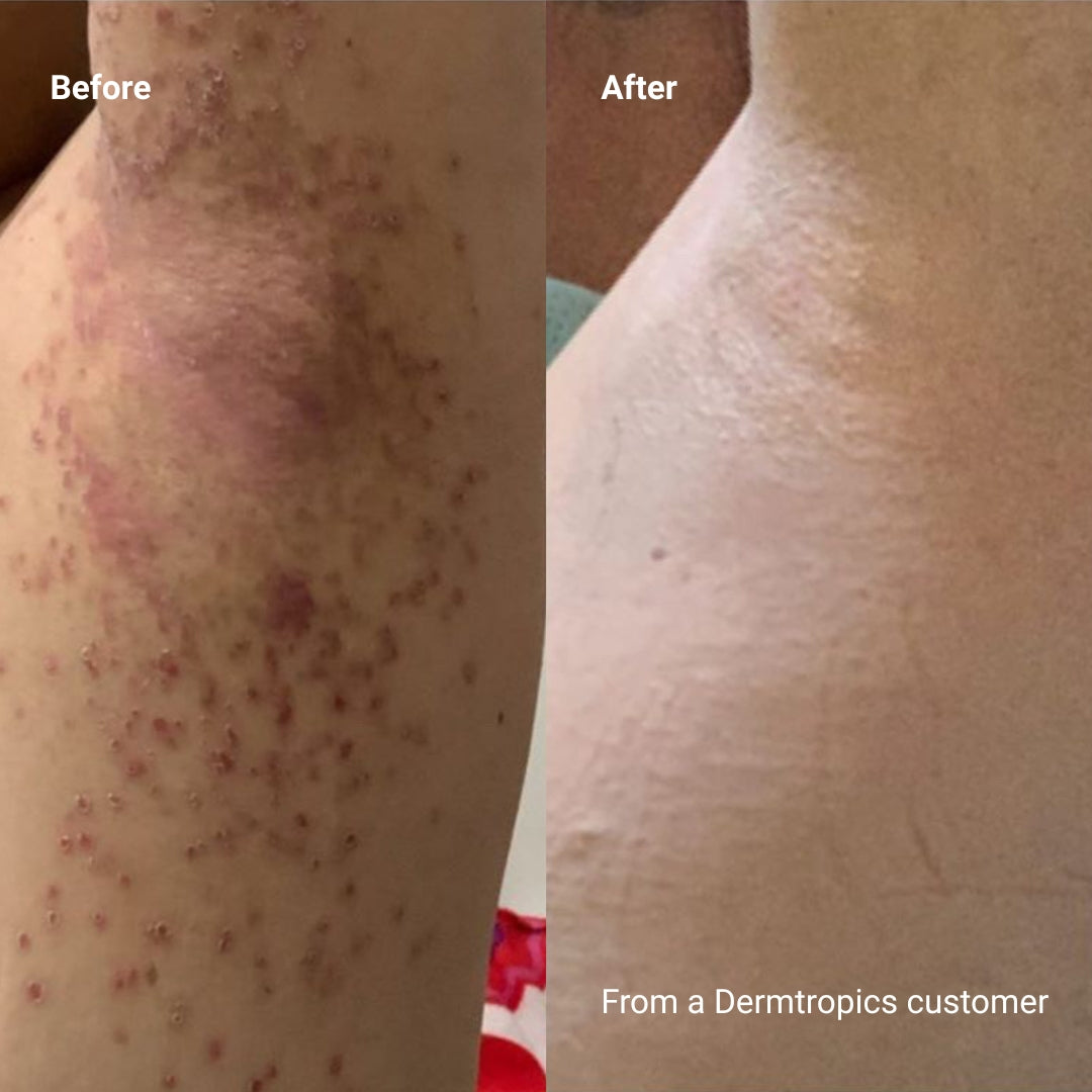 Dermtropics Raw Coconut + Colloidal Oatmeal Hand and Body Wash